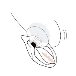 Как использовать Liberty 2